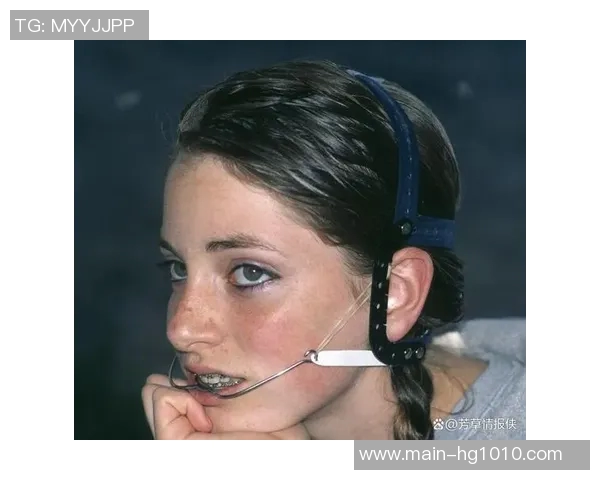 亚马尔自信分享戴牙套体验称其外观与自我形象完美契合 亚马尔自信分享戴牙套体验称其外观与自我形象完美契合